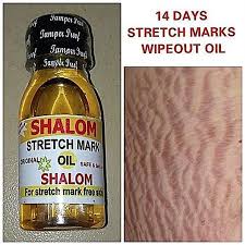 Shalom stretch mark oil