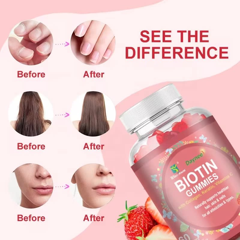 DAYNEE Biotin Keratin Collagen Gummies organic Biotin Gummy for Hair Skin and Nails Vitamins Supplement