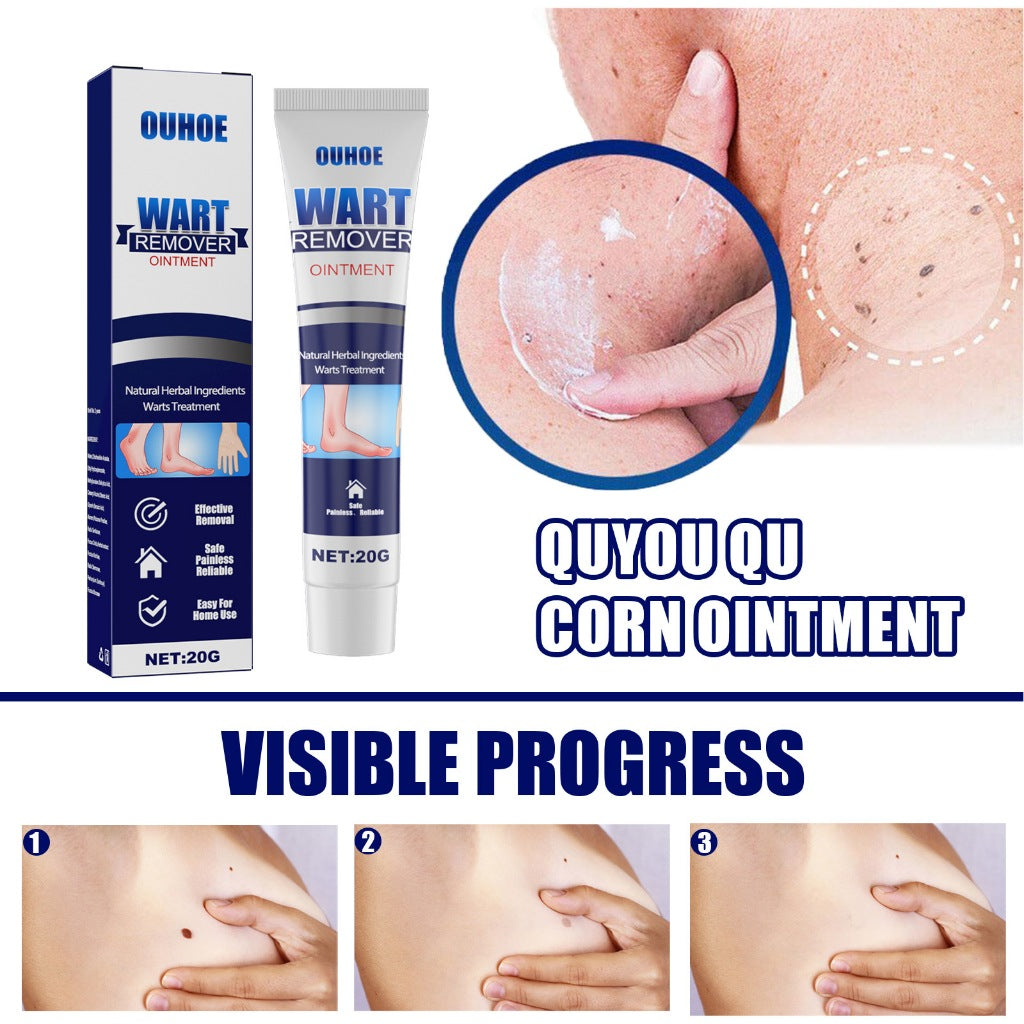 Ouhoe wart remover ointment