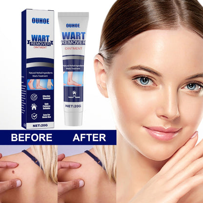 Ouhoe wart remover ointment