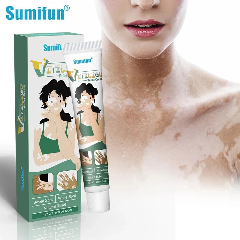 Sumifun Vitiligo Relief Cream