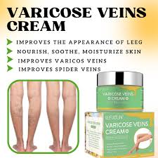 Guanjing Varicose Vein Cream Spider Varicose Vein Cream Improves Blood