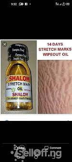 Shalom stretch mark oil