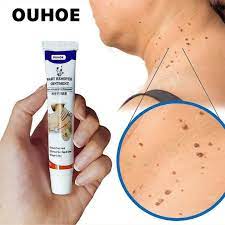 Ouhoe wart remover ointment