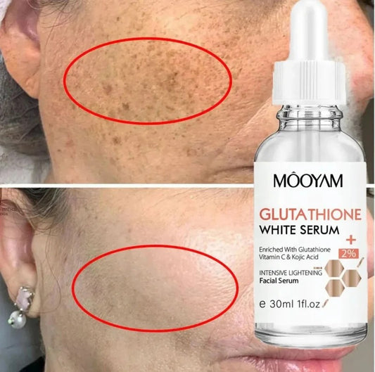 MOOYAM Glutathione Whitening Serum (30ml)