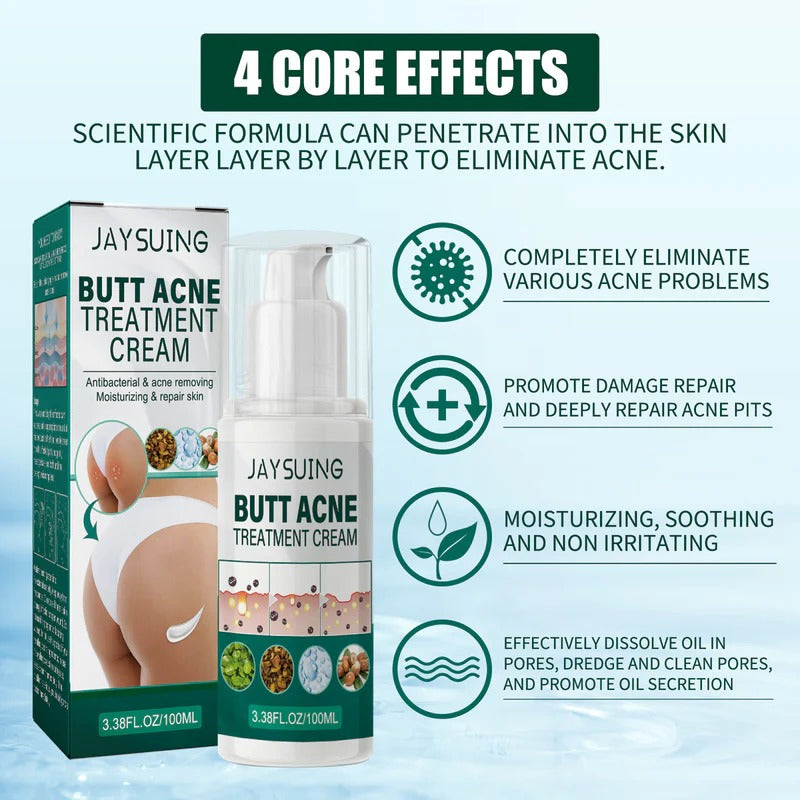 Jaysuing Butt Acne Treatment Cream (30 g)