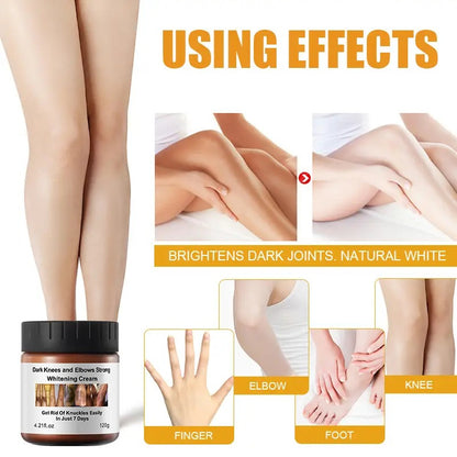 MOOYAM Dark Knees and Elbows Strong Whitening Cream (120g)