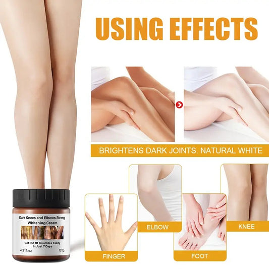 MOOYAM Dark Knees and Elbows Strong Whitening Cream (120g)