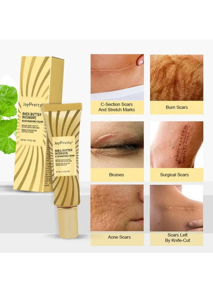 JoyPretty Shea Butter Intensive Scar Vanishing Cream (40 g)