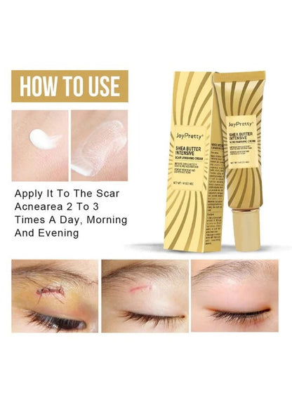 JoyPretty Shea Butter Intensive Scar Vanishing Cream (40 g)