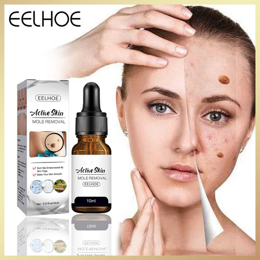 EELHOE Active Skin Mole Removal Serum