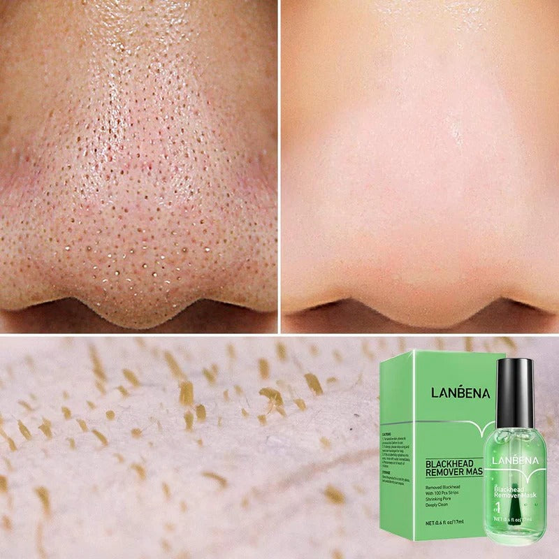Lanbena Blackhead Remover Mask