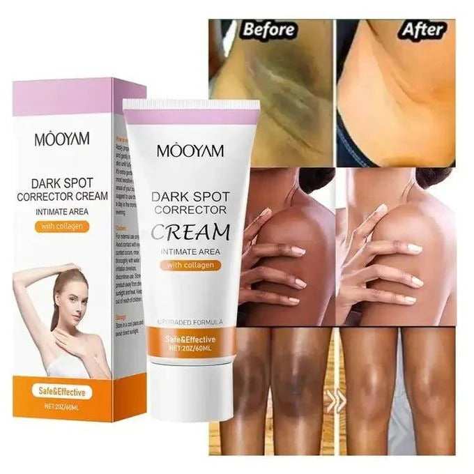 MOOYAM Dark Spot Corrector Cream