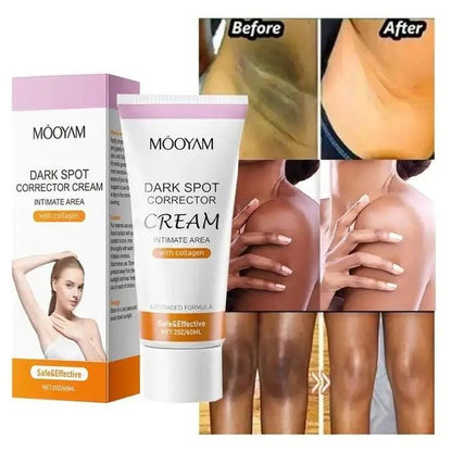 MOOYAM Dark Spot Corrector Cream