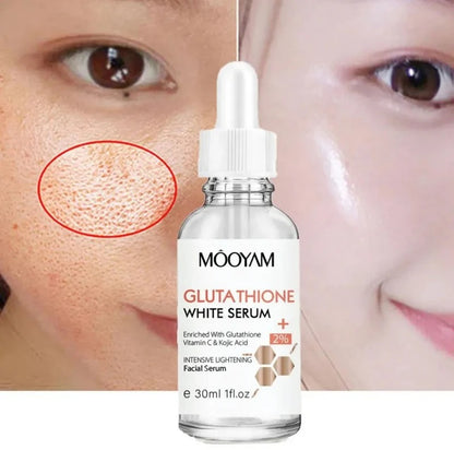MOOYAM Glutathione Whitening Serum (30ml)