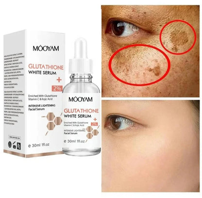 MOOYAM Glutathione Whitening Serum (30ml)