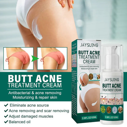 Jaysuing Butt Acne Treatment Cream (30 g)