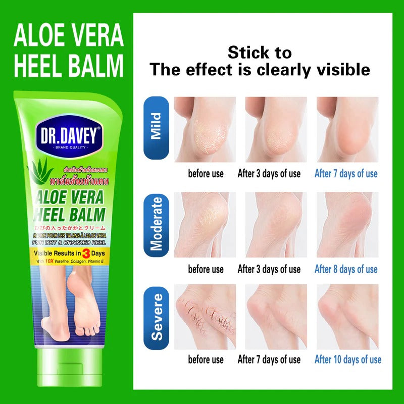 Dr. Davey Aloe Vera Heel Balm Feet Cream
