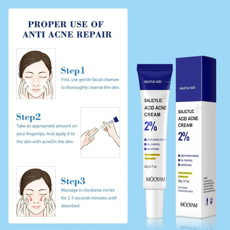 MOOYAM Salicylic Acid Acne Cream