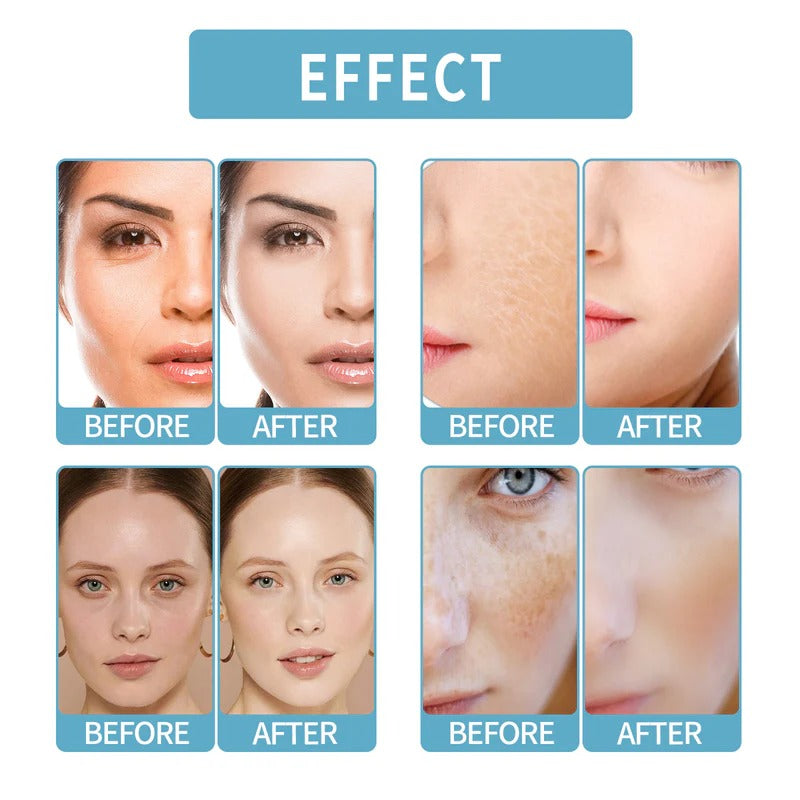EELHOE Hydra Max B5 Firming & Brightening Serum