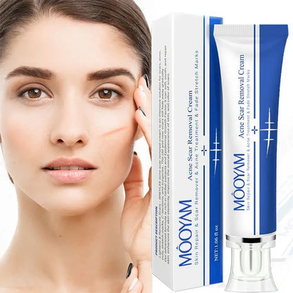 MOOYAM Strong Effective Acne Scar Removal Cream