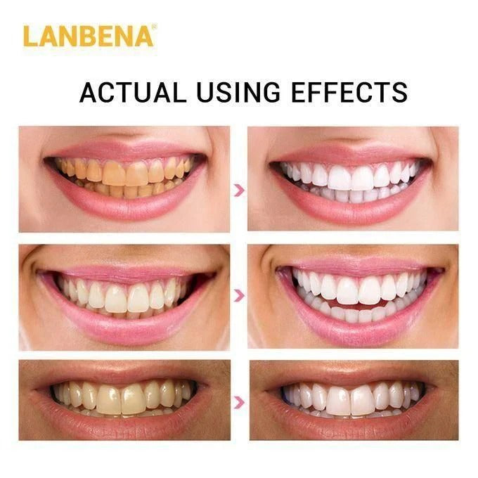 LANBENA Teeth Whitening Strips with Bamboo Charcoal