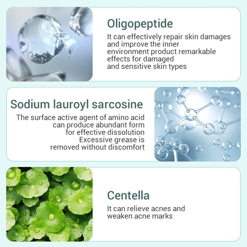 LANBENA Acne Treatment Facial Cleanser