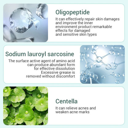 LANBENA Acne Treatment Facial Cleanser