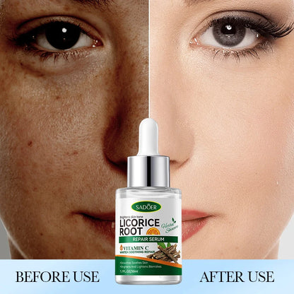 SADOER Licorice Root Vitamin C Repair Serum 30 ML