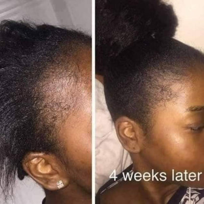 🔥 BUY 1 GET 1 FREE — King of Ginger 7-Day Hair Growth Oil | Stop Breakage + Regrow Hair | KSh 1,800 (C)