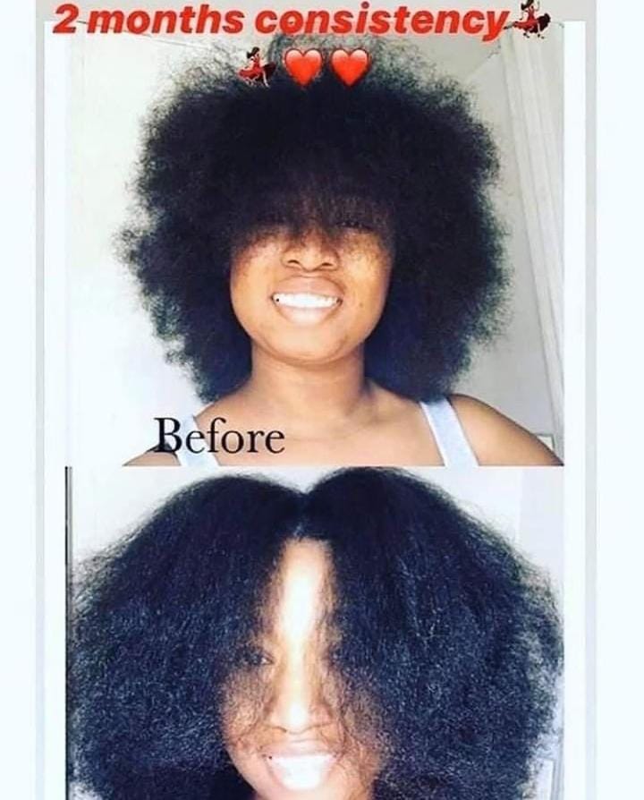 🔥 BUY 1 GET 1 FREE — King of Ginger 7-Day Hair Growth Oil | Stop Breakage + Regrow Hair | KSh 1,800