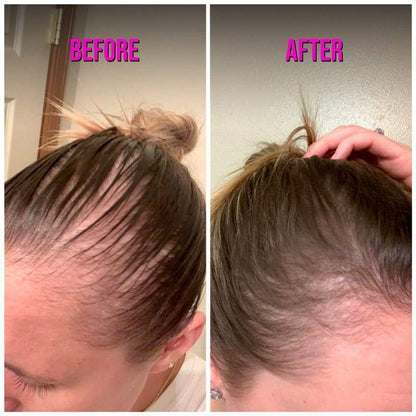 🔥 BUY 1 GET 1 FREE — King of Ginger 7-Day Hair Growth Oil | Stop Breakage + Regrow Hair | KSh 1,800 (A))