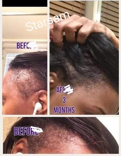 🔥 BUY 1 GET 1 FREE — King of Ginger 7-Day Hair Growth Oil | Stop Breakage + Regrow Hair | KSh 1,800 (A))