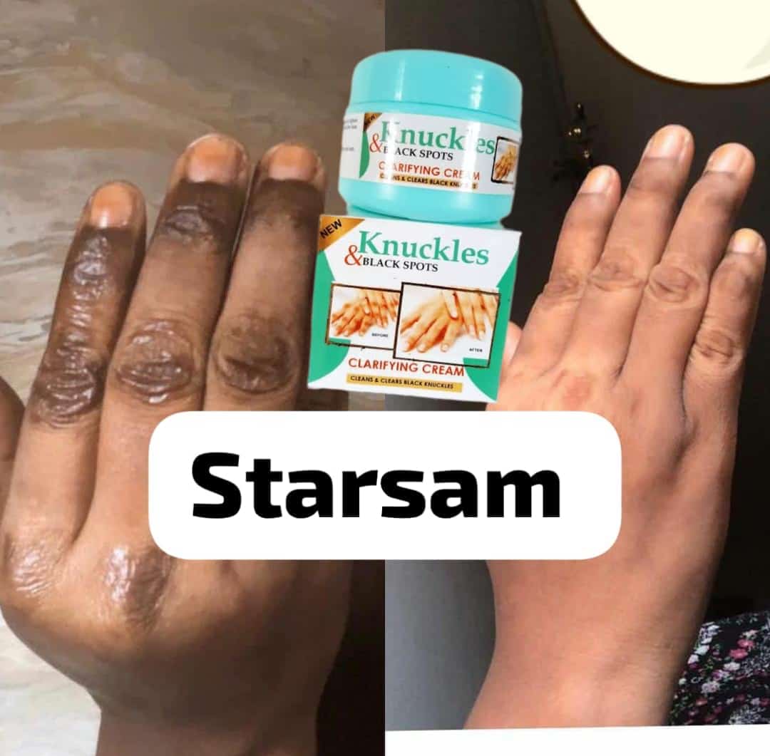 🔥 LIMITED DEAL — Skin Beauty Dark Knuckles & Black Spot Cream | Clears Knuckles + Elbows + Knees + Dark Spots | KSh 1,800