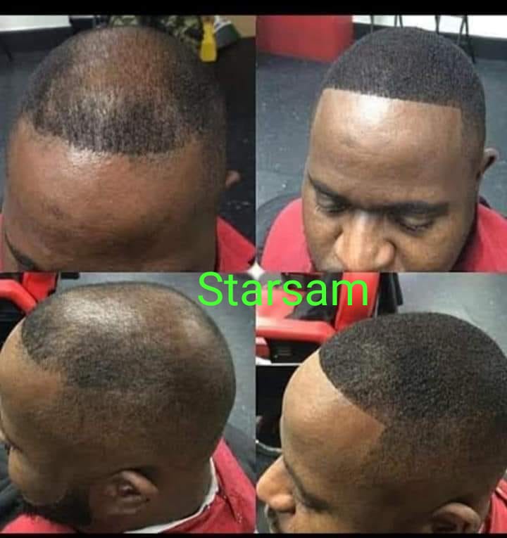 🔥 BUY 1 GET 1 FREE — King of Ginger 7-Day Hair Growth Oil | Stop Breakage + Regrow Hair | KSh 1,800 (C)