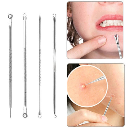 4pcs Blackhead Remover Kit – Stainless Steel Acne & Pimple Extractor Set