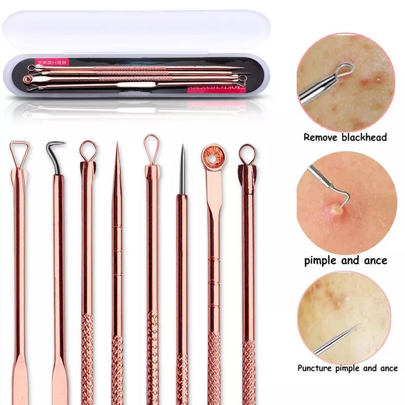 4pcs Blackhead Remover Kit – Stainless Steel Acne & Pimple Extractor Set