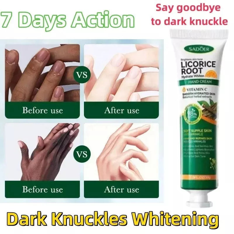 SADOER Fast Whitening Dark Knuckles Brighten Hand Cream Melanin Corrector Moisturizing