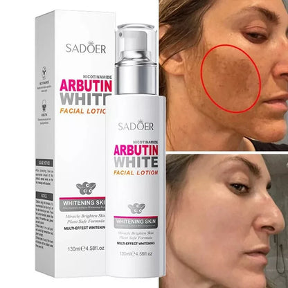 Sadoer Arbutin White Face Lotion